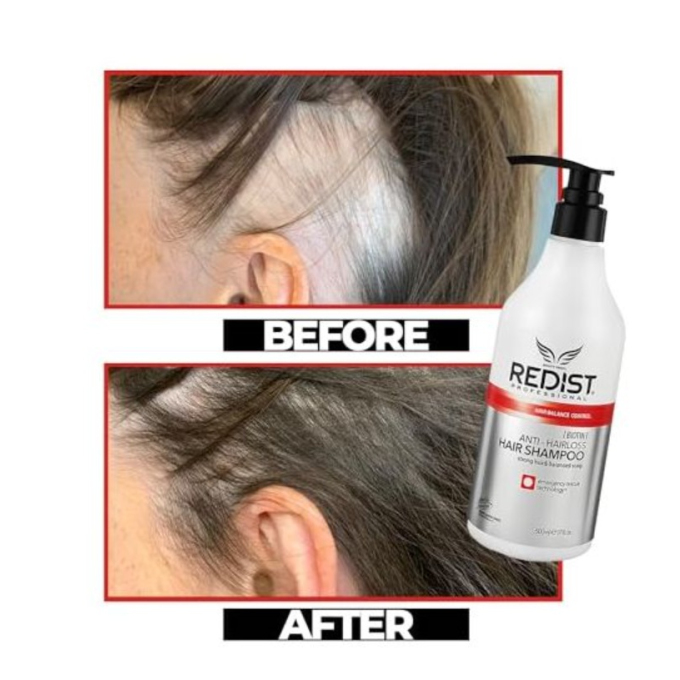 Redist Biotin Anti-Hairloss šampón proti vypadávaniu vlasov 500 ml
