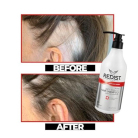 Redist Biotin Anti-Hairloss šampón proti vypadávaniu vlasov 500 ml